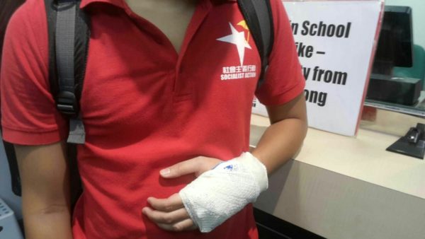 一名示威者在西班牙領事館被襲擊，手部受傷